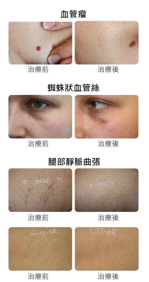 案例照片3