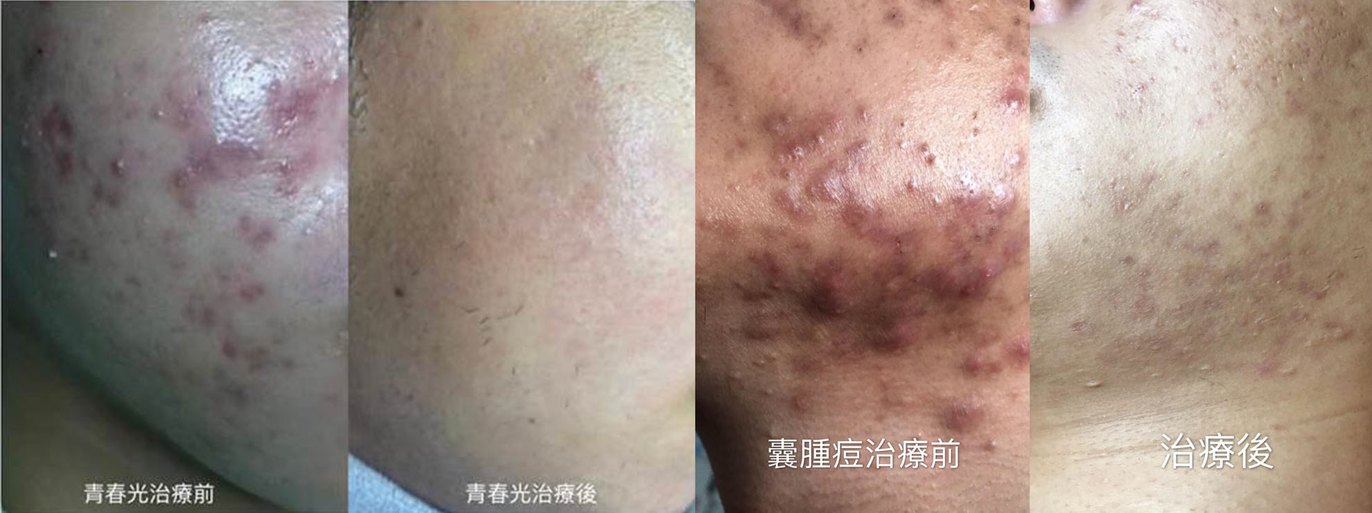 案例照片