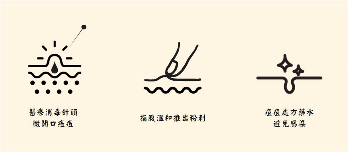 醫療清痘步驟