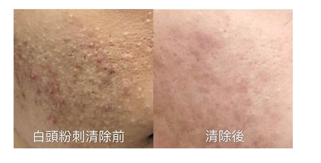 案例照片